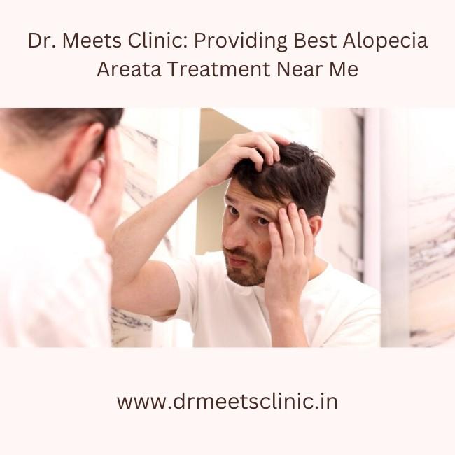 Alopecia Areata Treatment Near Me