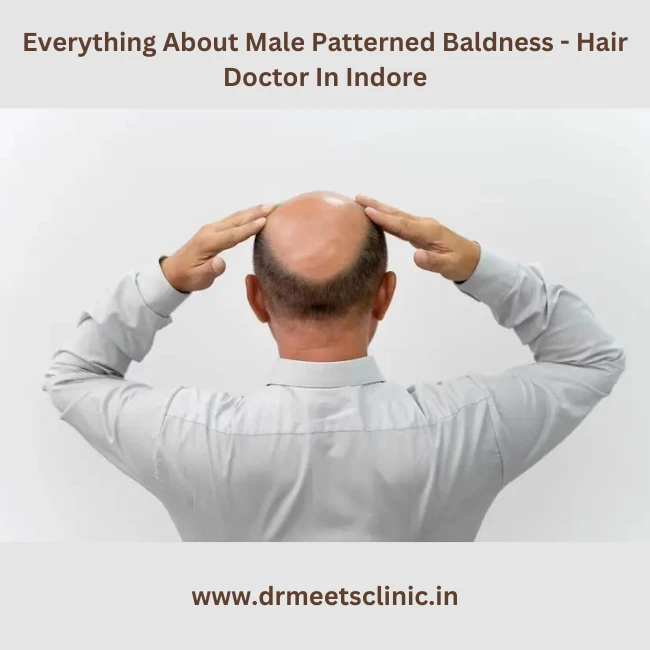 Male Patterned Baldness