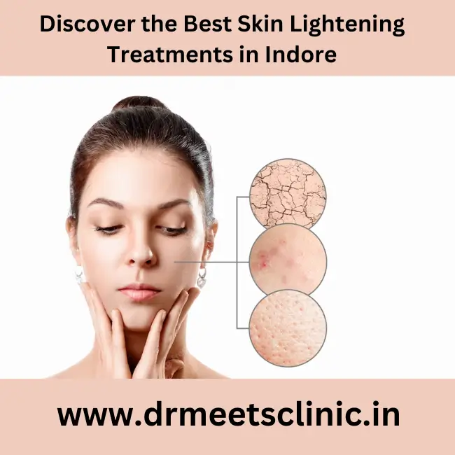 skin lightening in Indore