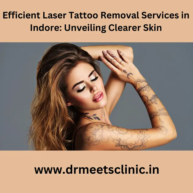 Erase Ink with Tattoo Removal Treatment | Dr. Venus