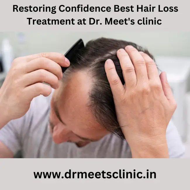 Best Hair loss treatment in Indore