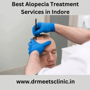 Best Alopecia Treatment in Indore